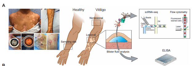lesions